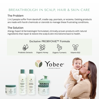 Ultra Gentle Soothing Scalp Mask™ for Babies